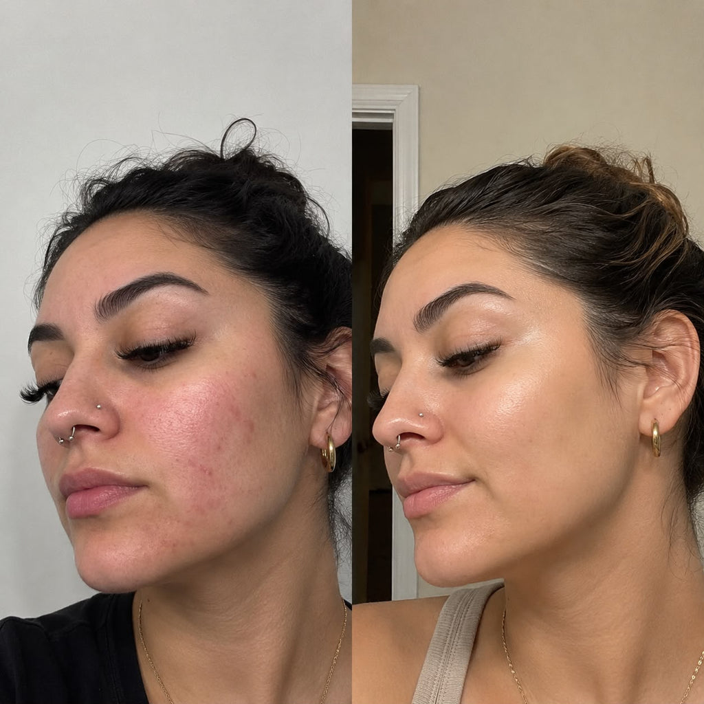 Led Facial beauty instrument